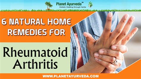 6 Natural Home Remedies For Rheumatoid Arthritis - YouTube