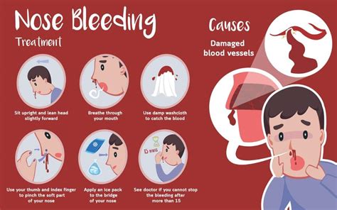 Nose Bleed - Spiritual Meaning (Right & Left) + Bible Meaning ...