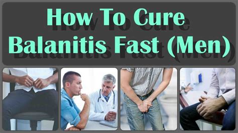 How To Cure Balanitis With Oils Fast And Causes, Symptoms, And ...