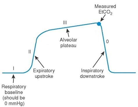 Basic Capnography Interpretation — NUEM Blog