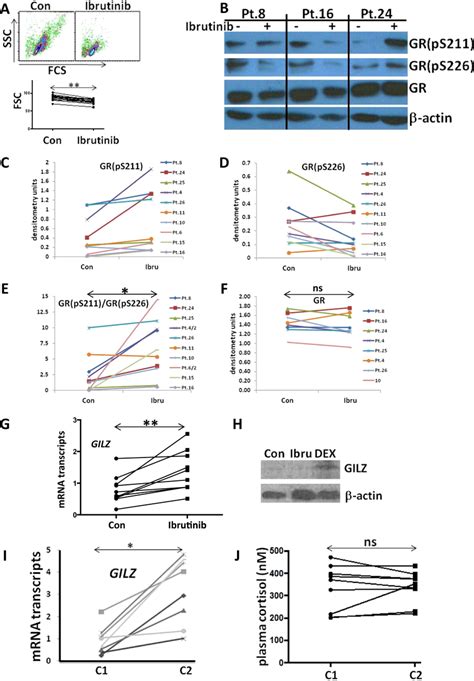 Ibrutinib activates glucocorticoid-receptor responses in circulating ...