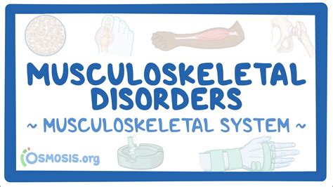 Musculoskeletal system: Musculoskeletal disorders: Video, Causes ...