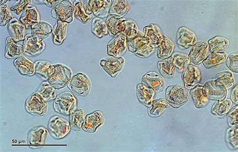 Tree Pollen Under Microscope