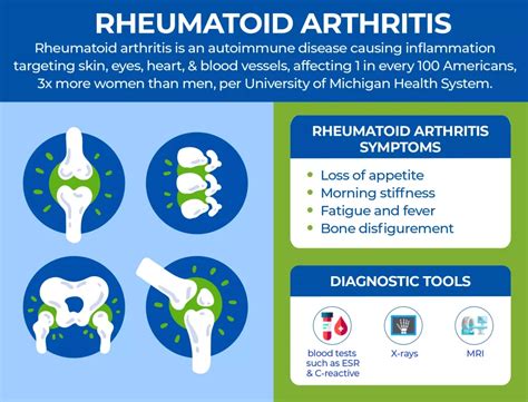 Osteoarthritis Vs Rheumatoid arthritis What you should know