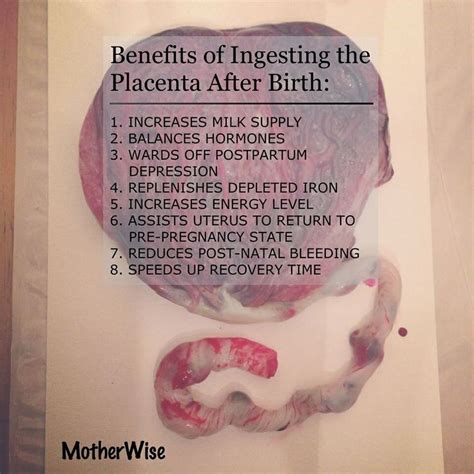 45 best Birth : Placenta & Umbilical Cord images on Pinterest