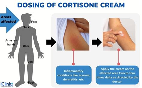 What Is Cortisone Cream Used For?