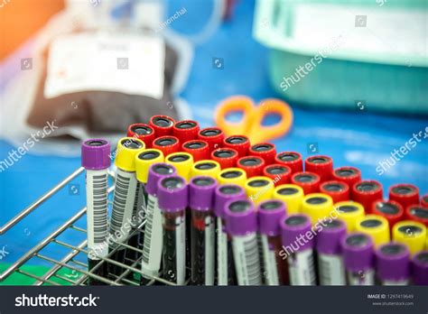 Rack Blood Tubes Barcode Labels Proper Stock Photo 1297419649 ...