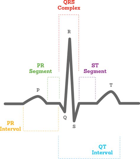 Ecg trace explained