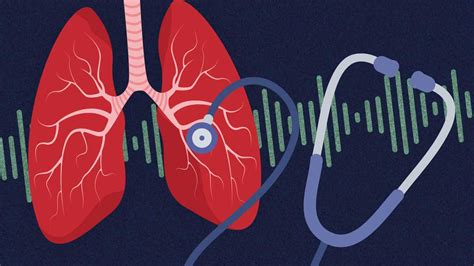 Lung Sounds Made Easy (With Audio) | Ausmed