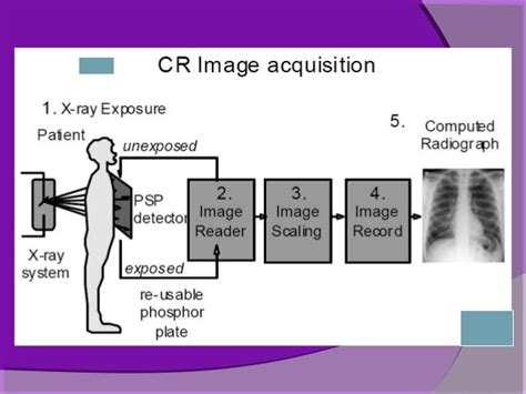 Computed radiography