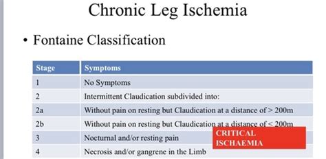 Intermittent Claudication (IC) Flashcards | Quizlet