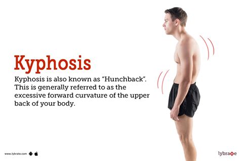 Kyphosis: Symptoms, Causes, Treatment, Cost, and Side Effects