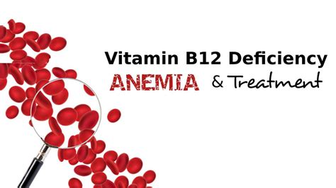 Vitamin B12 Deficiency Anemia And Treatment