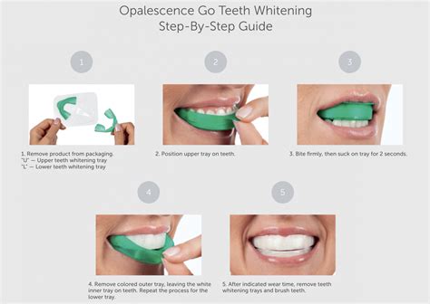 How to Use Opalescence Tooth Whitening - Baird Orthodontics | Pleasanton CA