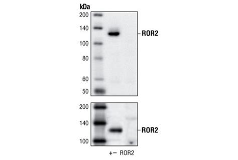 ROR2 Antibody | Cell Signaling Technology