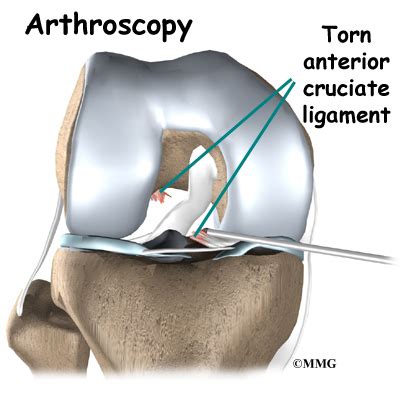 Patient Education | Concord Orthopaedics