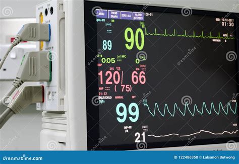 Monitor Vital Sign And EKG Monitor In ICU Unit ,it Show The Waves Of ...