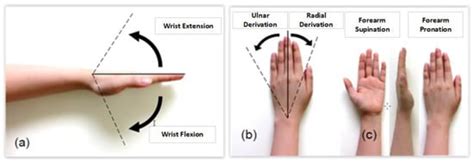 Bioengineering | Free Full-Text | A New Wrist–Forearm Rehabilitation ...