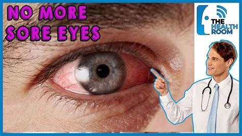 How to CURE SORE EYES NATURALLY: 10 Effective Ways (2021) - YouTube