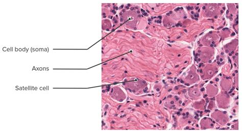 Peripheral Nerve Histology Cross Section