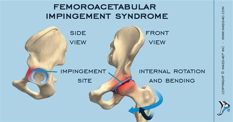 Femoroacetabular Joint