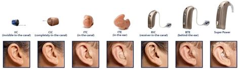 Hearing Aid Styles: In-The-Ear vs Behind-The-Ear. Pros vs Cons ...