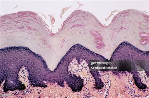 Skin Desquamation Dermis Sweat Gland Ducts And Desquamating Cells ...