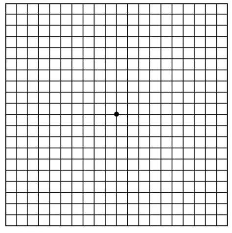 Macular Degeneration: Using Amsler Grid - www.scottsdaleeye.com