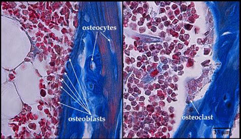 Osteoclast Histology