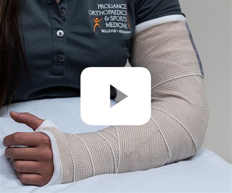 Physician Splinting Guide | Proliance Orthopaedics & Sports Medicine