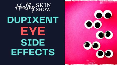 Dupixent Eye Side Effects: What's Going On? {RESEARCH} | Dr. Roselie ...