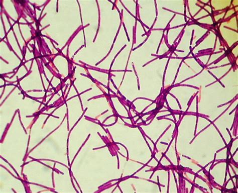 Bacillus anthracis - Bactéria e o Anthrax - InfoEscola