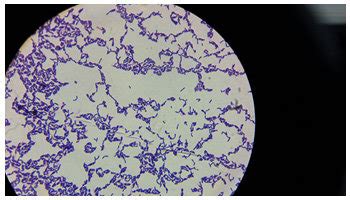 Gram-positive Lactobacillus spp. under the light microscope | Download ...