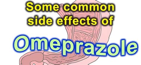 Learn the Side Effects of Omeprazole - Ashcroft Pharmacy