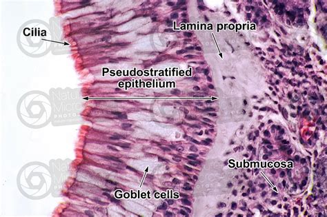 Man. Nasal mucous membrane. Vertical section. 500X - Man - Mammals ...