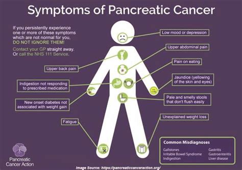 Five Early Warning Signs Of Pancreatic Cancer That Could Save A Life