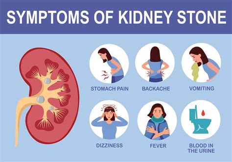 Kidney Stones - Plainfield Spine and Rehabilitation