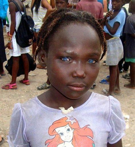 El milagro de la naturaleza: 15 niños negros con los ojos azules. Página 1