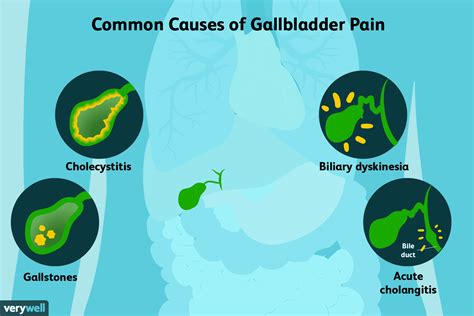 What Causes Gallbladder Pain?