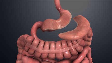 Bariatric Surgery Complications in the ED - EMOttawa Blog