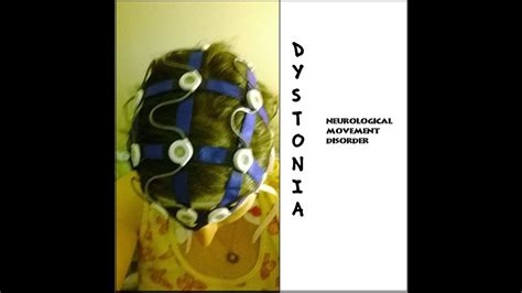 Dystonia - YouTube