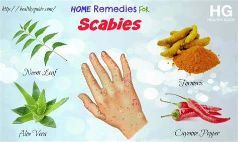 What Is A Scabies Rash Scabies Home Remedies | Images and Photos finder