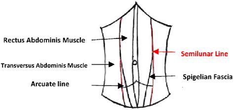 Semilunar line (Red arrow). (For interpretation of the references to ...