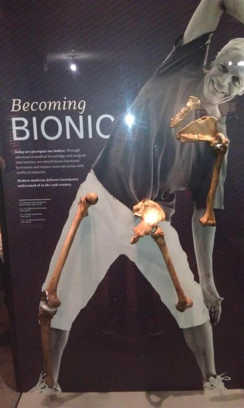 BIONIC FOR REAL | Welcome to HipRunner.com