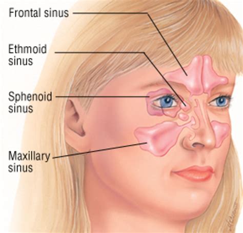 Sinusitis - A very lowering and painful infection. | HubPages