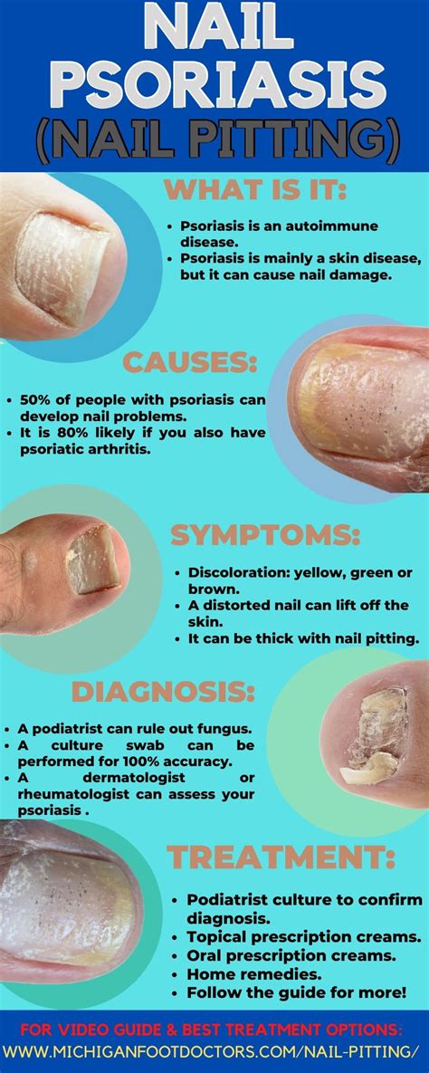 Psoriasis Under The Toenails: [Nail Pits, Causes & Best Treatment]