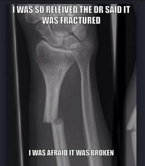 Oh, it's just a fracture. | Radiology humor, Xray humor, Xray tech humor