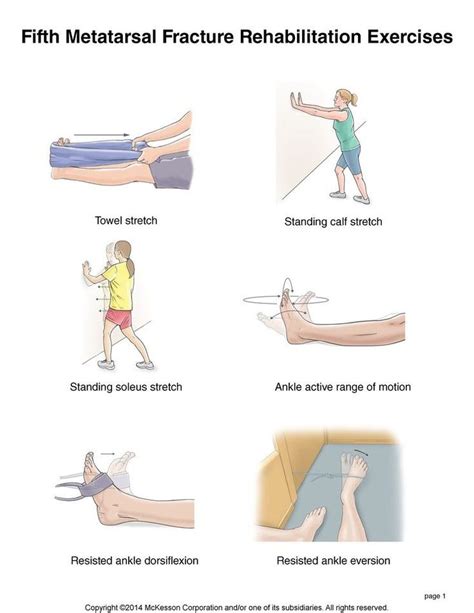 Summit Medical Group - Foot Fracture: Fifth Metatarsal Fracture ...