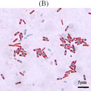 PCR using UBC 459 Primer. RAPD-PCR patterns of BS11 and reference ...