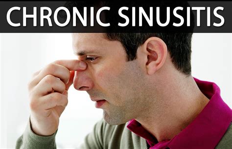 Chronic Sinusitis - Causes, Symptoms, Surgery, and Treatment